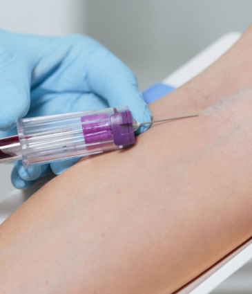 Blood Testing Featured Image Randr