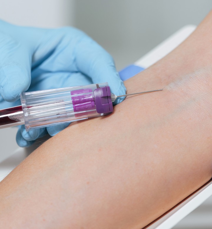 Blood Testing Featured Image Randr