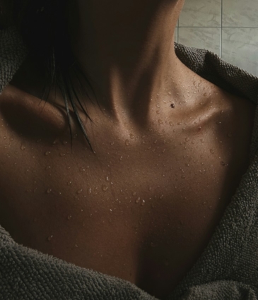 hyperhidrosis conditions feat rr