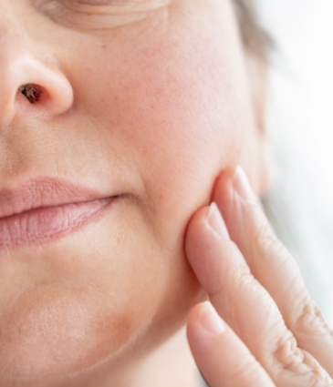 Jowls Conditions Feat Rr