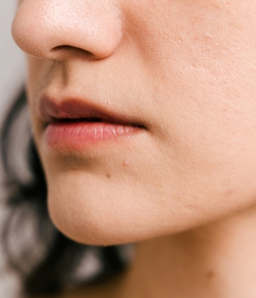 Thin Lips Conditions Feat Rr