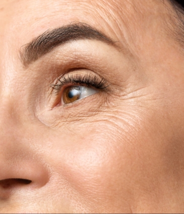 wrinkles conditions feat rr