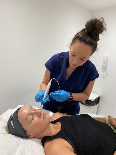 Microneedling Leeds