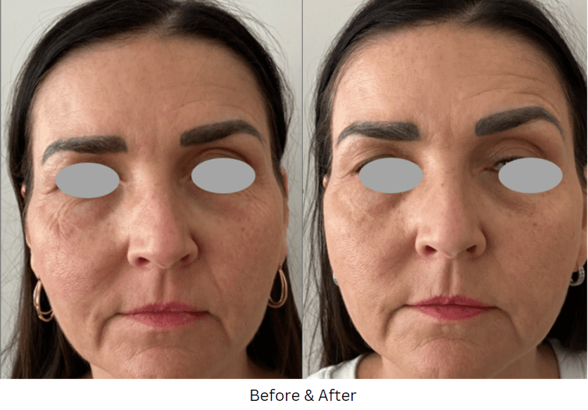 Polynucleotides garforth before and after