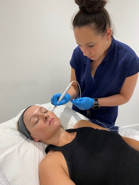 Microneedling Leeds