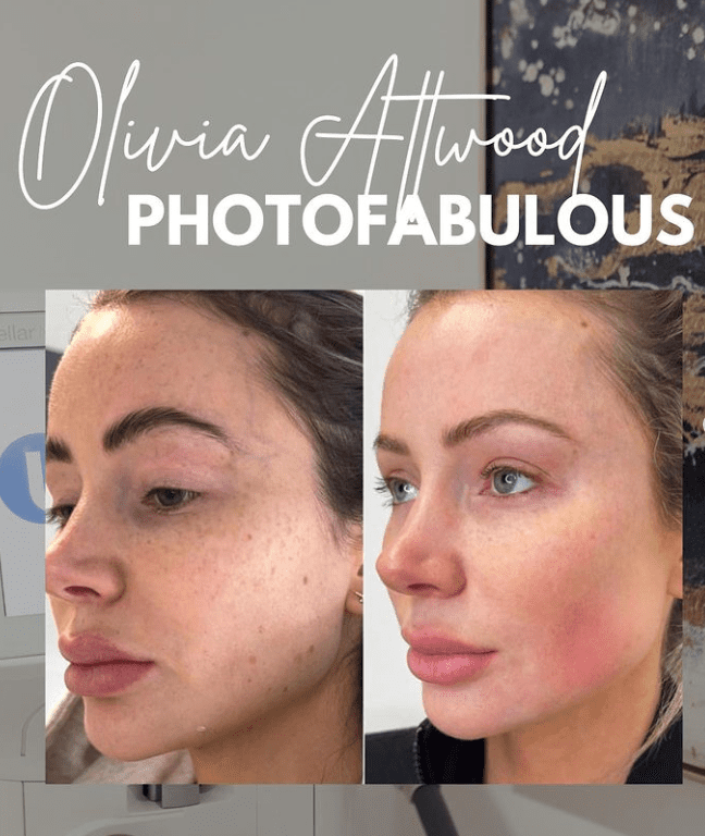 photofabulous before and after