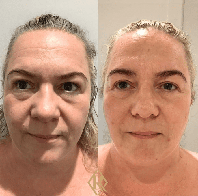 Alumier skincare before and after